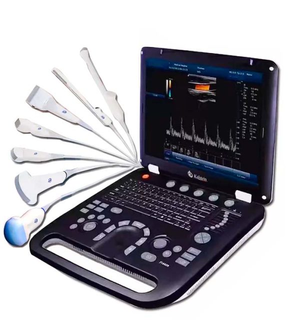 Ultrasound scan: characteristics and types