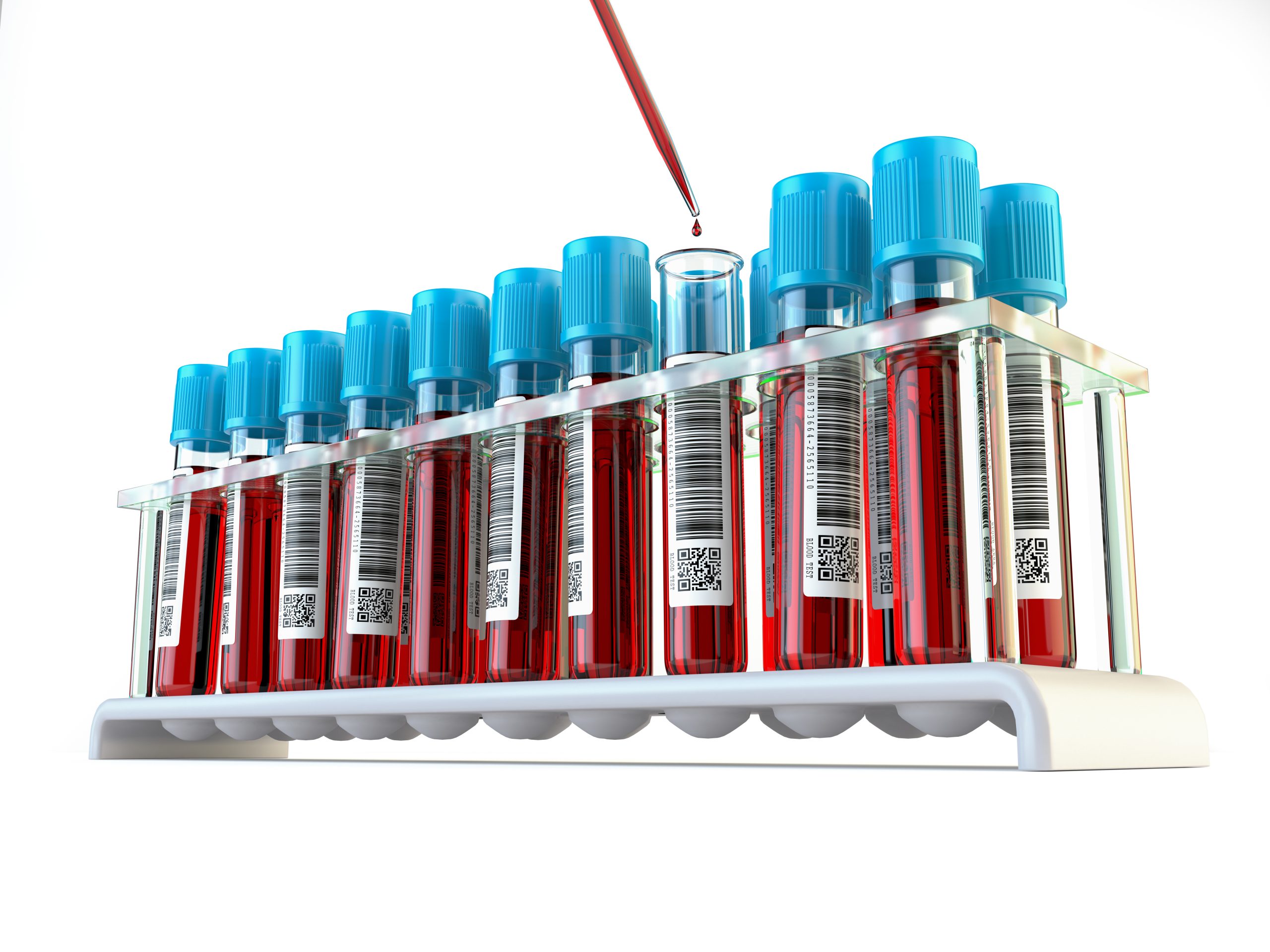 Do you know what the clinical utility of blood tubes is?