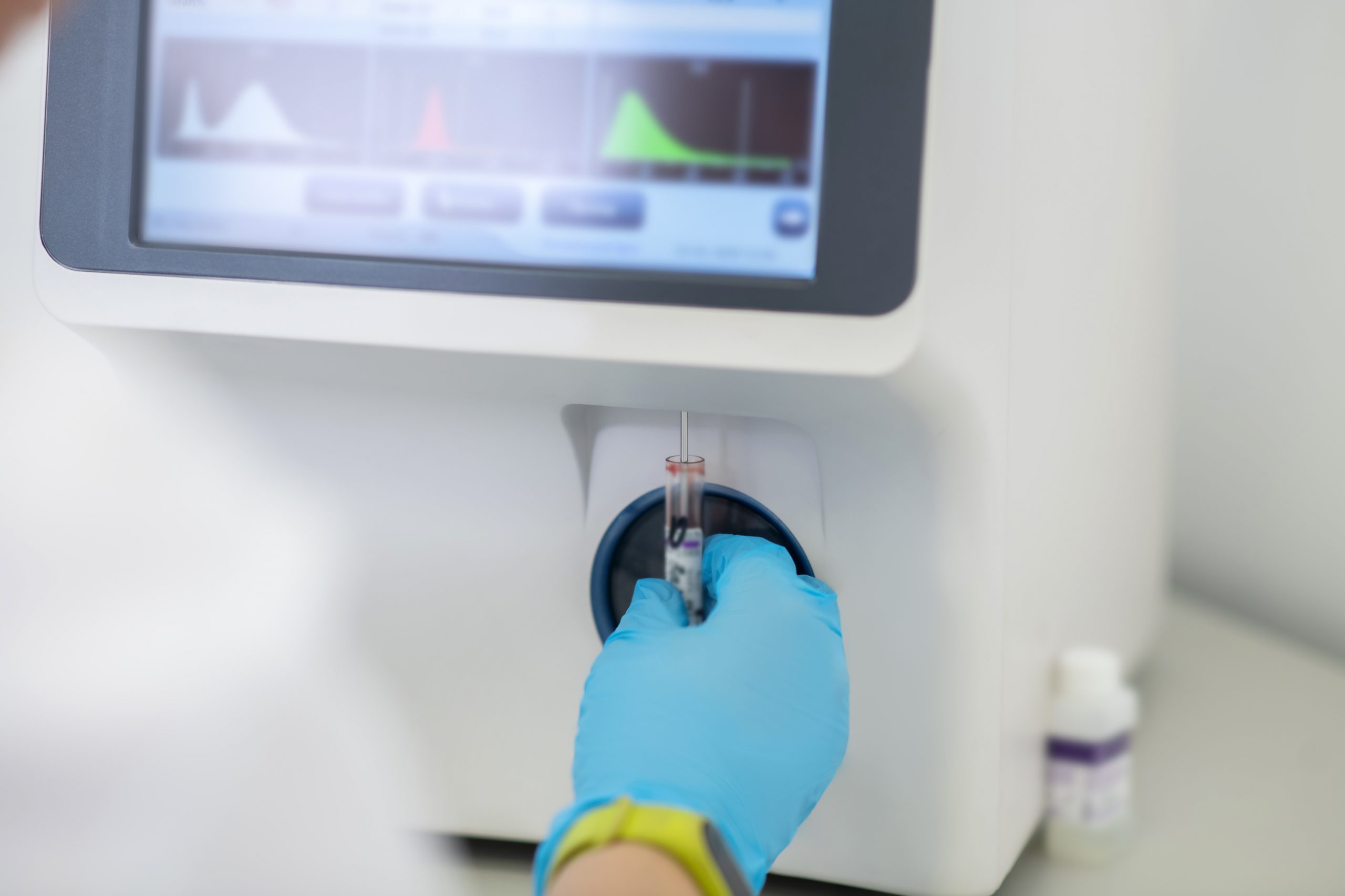 Clinical chemistry analyzers: care and recommendations